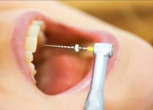 تعرف على طرق علاج "عصب الأسنان" الحديثة.. يحافظ على الضرس بنسبة 95%