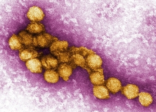 إسبانيا تعلن وفاة شخص وإصابة 35 بفيروس حمى غرب النيل