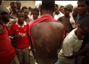 مهاجرون أفارقة في اليمن تعرّضوا للتعذيب والاغتصاب