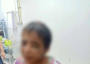 فيديو.. الطفلة "أمنية" ضحية التعذيب بكفر الشيخ تروي تفاصيل الواقعة