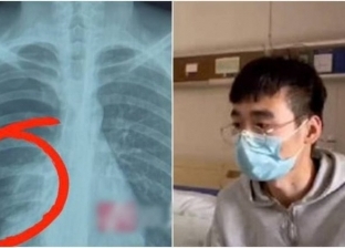 شاب صيني يتعرض لانفجار في الرئة لسبب غريب: «حاول يغني كاريوكي»