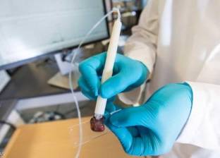 علماء أمريكيون يطورون قلما يكشف عن الخلايا السرطانية في 10 ثوانٍ
