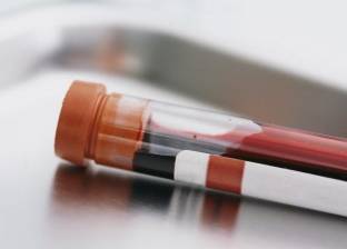 تحليل دم يعرفك المتبقي من عمرك
