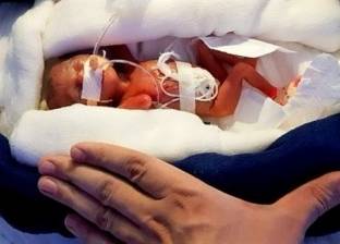 طفلة بحجم لوح شيكولاته تنجو من الموت بعد ولادتها قبل موعدها بـ3 أشهر