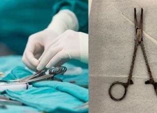استخراج آلة جراحية ظلت داخل بطن سيدة 6 سنوات بالمنصورة.. عملية معقدة