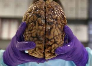 علماء آثار من بريطانيا: العثور على أقدم "دماغ" بشري
