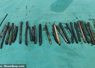 شفرات حلاقة وسكاكين.. أطباء يستخرجون 30 قطعة معدنية من معدة رجل هندي
