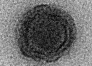 اكتشاف "فيروس غامض" اسمه "يارا" في البرازيل