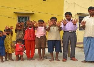بالفيديو| أسرة هندية تُحير العلماء بسبب عدد أصابعها