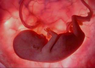 دراسة: عدم اكتساب الجنين للوزن المناسب أثناء الحمل مرتبط بـ"فصام الطفولة"