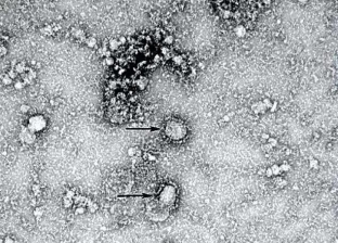 الصين: فيروس كورونا الجديد ينتقل بالرذاذ والتلامس.. والجميع معرض للإصابة