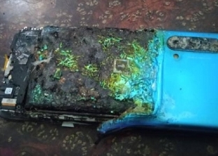 انفجار هاتف محمول من طراز منتشر في جيب صاحبه.. أصابه بجروح بالغة