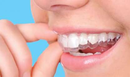 كيف تطورت صناعة أطقم الأسنان؟.. مرونة أكبر لراحة المرضى