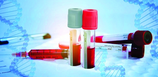اختبار دم يتنبأ باقتراب وفاة الشخص