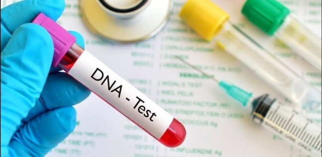 اختبار يكشف عن العيوب الجينية