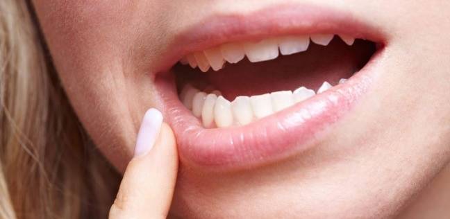 الذين يعانون من أمراض الفم والأسنان هم الأكثر عرضة للإصابة بضغط الدم المرتفع