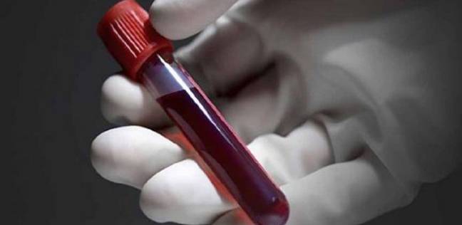 دراسة تكشف عن أنباء غير سارة لاصحاب فصيلة الدم الأولى "O"