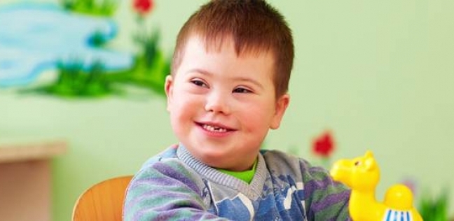 طفل مصاب بـ"متلازمة داون"