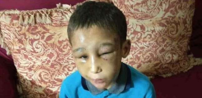 الطفل مصطفى ضحية التعذيب