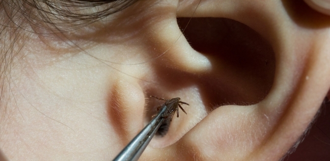 حشرة داخل الأذن - تعبيرية
