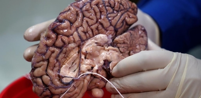 الدماغ البشرى