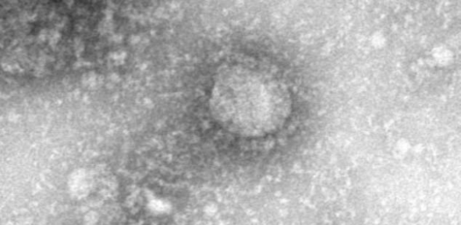 ظهور سلالة جديدة من فيروس كورونا المستجد