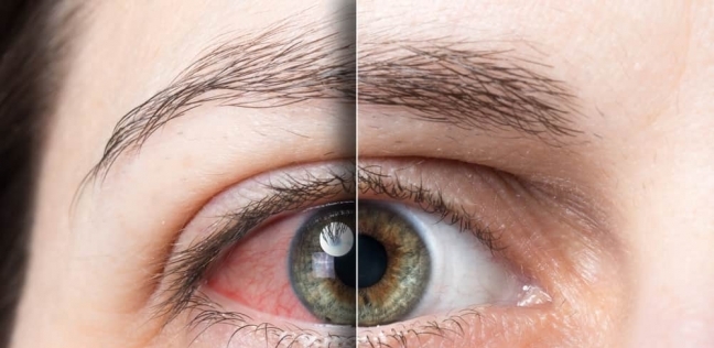 طبيب عيون يحذر من عادة خاطئة تسبب أمراضا خطيرة.. السر في استخدام «الموبايل» 