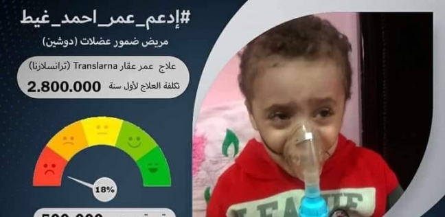 الطفل عمر أحمد مريض ضمور العضلات «دوشين»