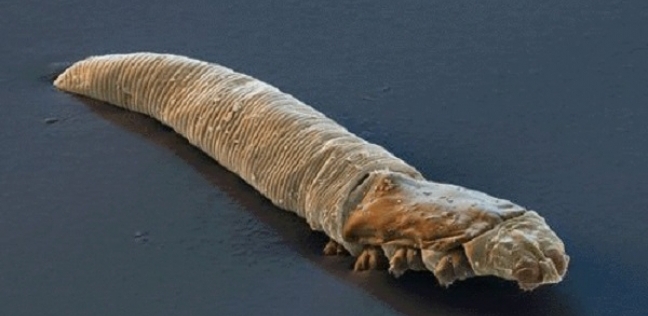 حشرة الديموديكس
