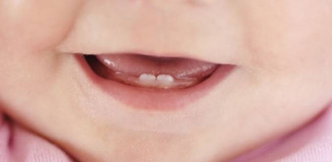 مفاهيم خاطئة عن الأسنان اللبنية.