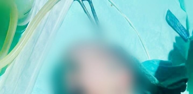 علي هيئة حورية بحر.. أغرب حالة ولادة لطفل في مستشفي أرمنت: مات بعدها ب 5 ساعات