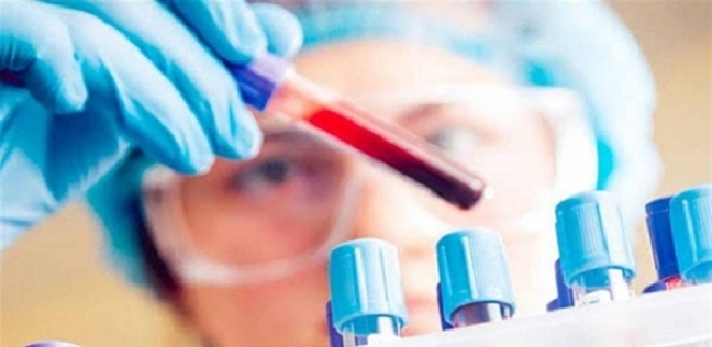 إختبار جديد للدم يستطيع إكتشاف 20 نوعا من السرطان