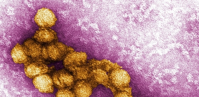 فيروس حمى غرب النيل