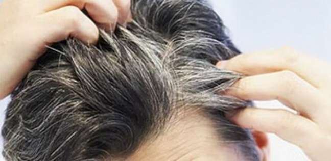 الفزع قد يؤدي إلى تحول أو تغيير بعض خصل الشعر إلى الأبيض