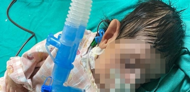 الطفل سليم أحمد على أجهزة التنفس الصناعي