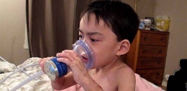 طفل مصاب بمرض نادر يستعين بـ"غاز الضحك" للتخفيف من آلامه اليومية