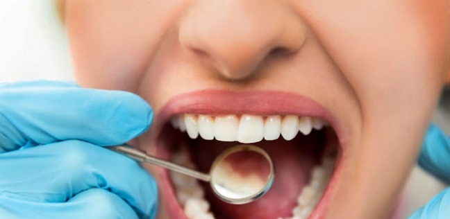 ناول الأطعمة التي تحتوي على السكريات والنشويات بكثرة يؤدي لتسوس الأسنان