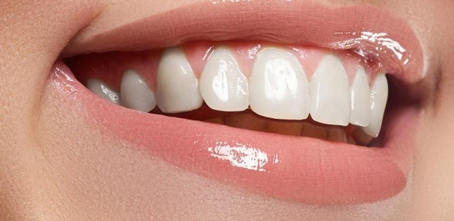 دراسة: تبييض الأسنان يسبب أضرار جسيمة بسبب المواد الكيماوية