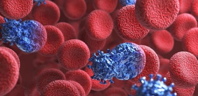 "دم المتبرعين".. طريقة جديدة لتدمير الخلايا السرطانية في روسيا