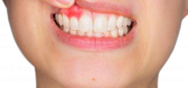 الحفاظ على صحة الأسنان