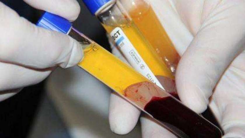 تصنيع مشتقات بلازما الدم