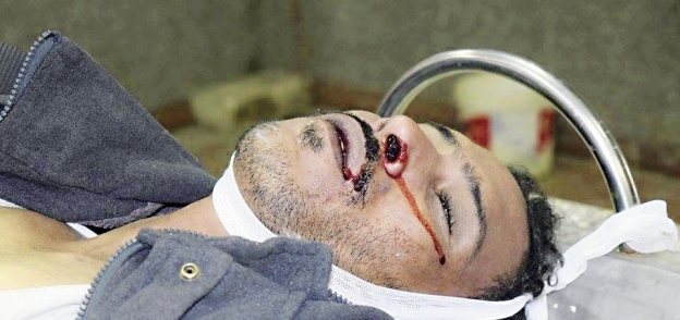 عمرو أبو شنب ضحية التعذيب بمركز شبين القناطر