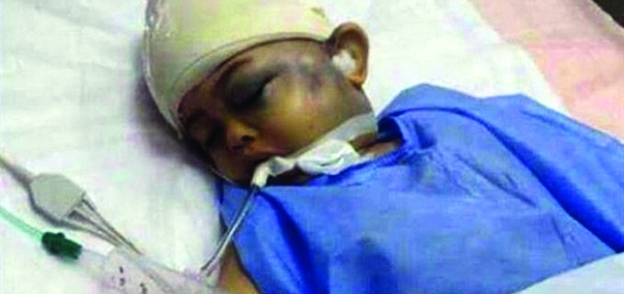 الطفل «حمزة» بعد الاعتداء عليه فى شهر رمضان الماضى