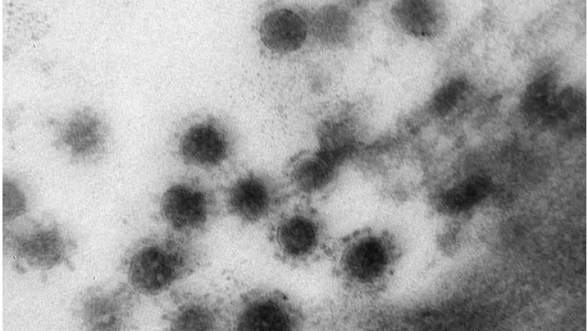 سلالة «دلتا» من فيروس كورونا