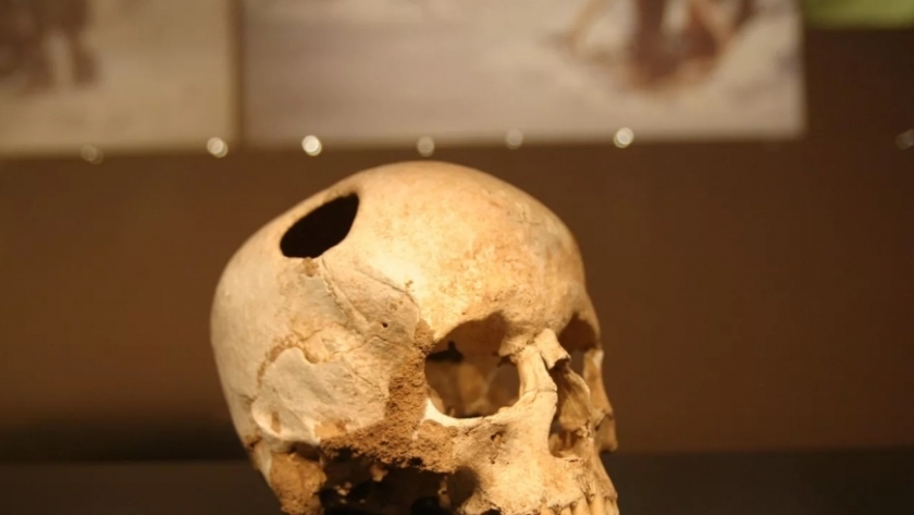 جمجمة بشرية-صورة أرشيفية