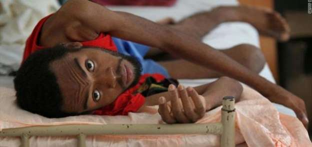 مرض "السل" أصبح مشكلة صحية خطيرة في غانا