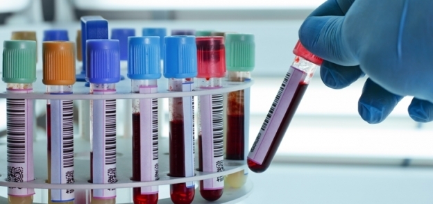تحليل عينة دم - أرشيفية