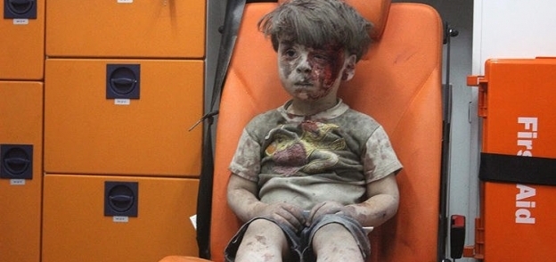 الطفل عمران السوري