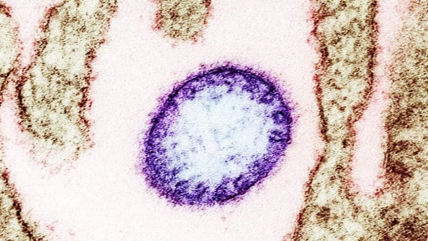 فيروس نيباه