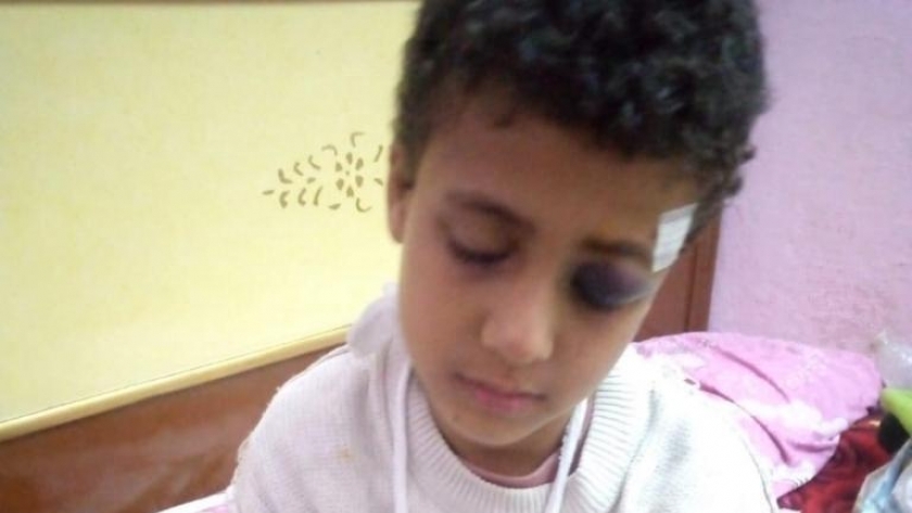 الطفل المصاب والمهم عامل بإلقاء من فوق مدرسة بسوهاج